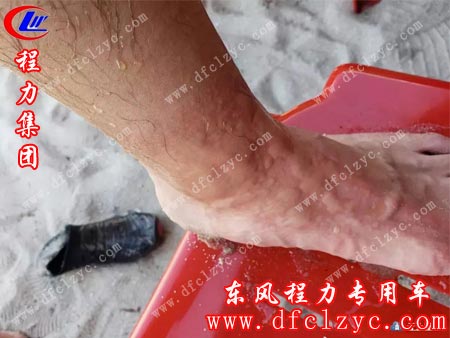 王邦勇中途被水母叮咬